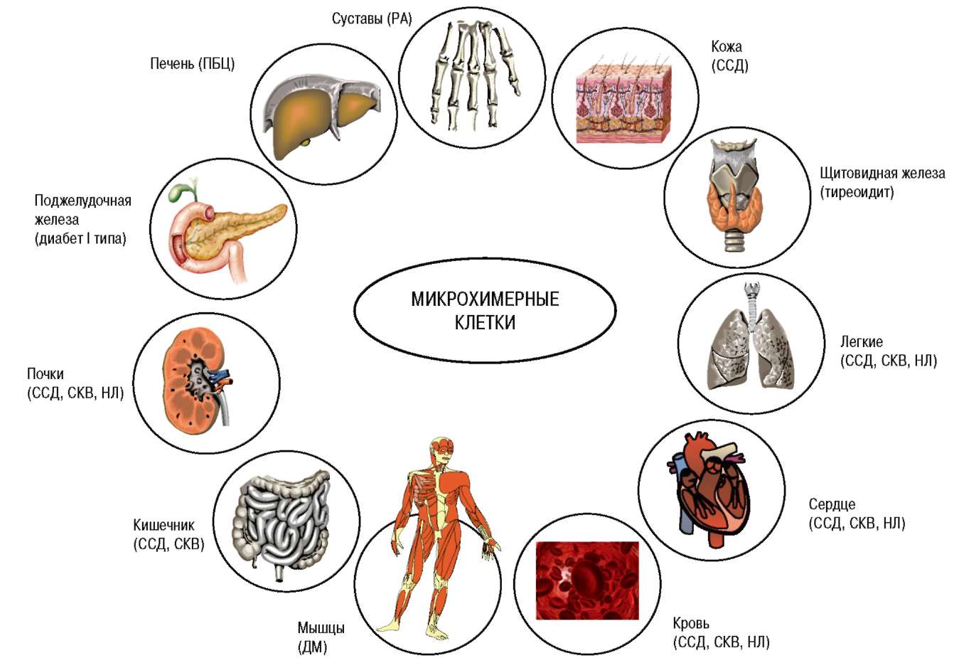 Парожаение орагнов при аутоимунном артрите Парожаение орагнов при аутоимунном артрите