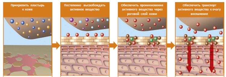 Действие пластыря Вольтарен на воспаление Действие пластыря Вольтарен на воспаление