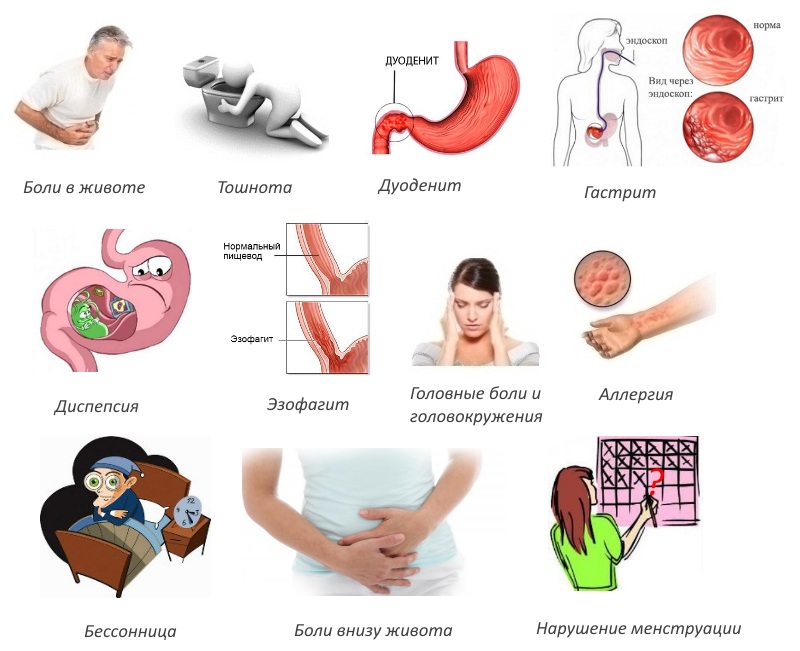 Побочные эффекты Артротека Побочные эффекты Артротека