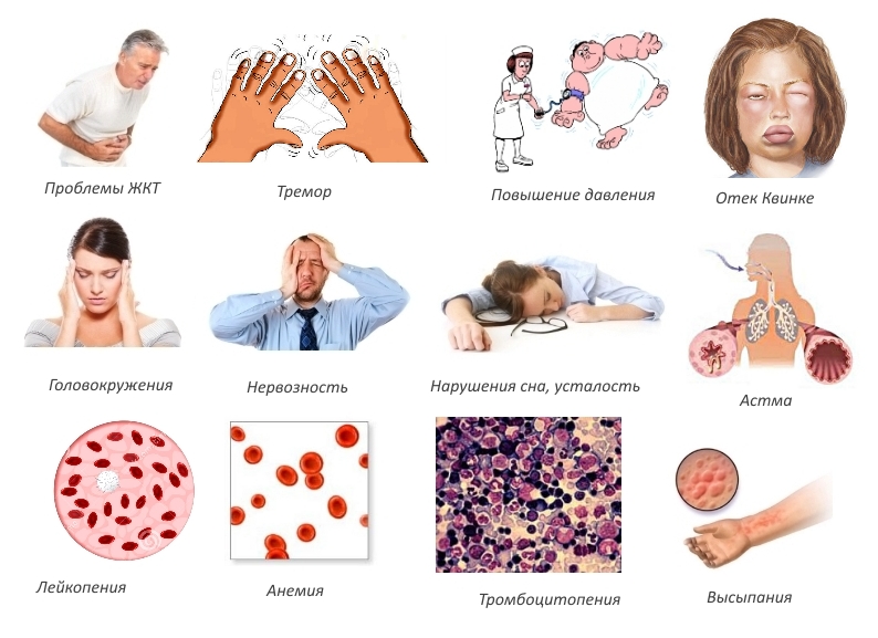 Побочные эффекты Кетопрофена Побочные эффекты Кетопрофена