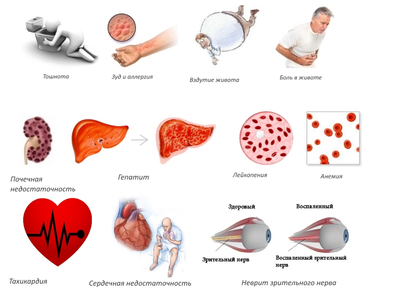 Побочные эффекты Терафлекс Адванс Побочные эффекты Терафлекс Адванс