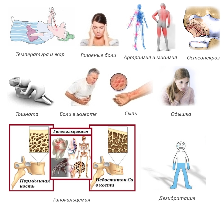 Побочные эффекты Золендроновой кислоты Побочные эффекты Золендроновой кислоты