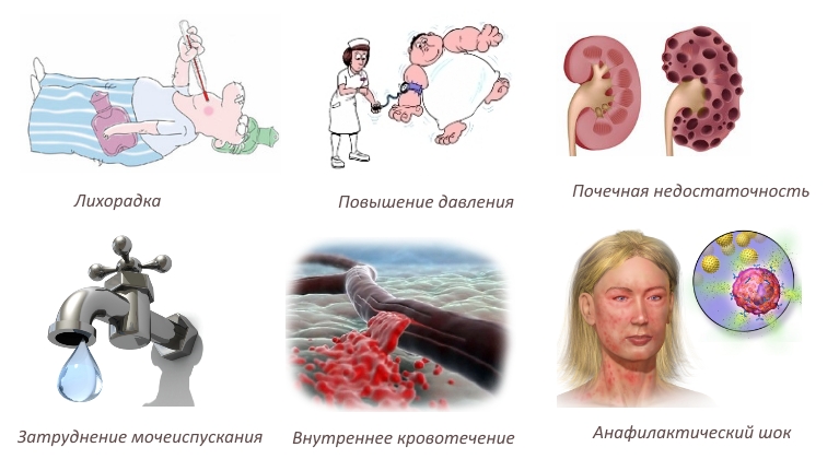 Побочные эффекты при передозировке Мелоксикама Побочные эффекты при передозировке Мелоксикама