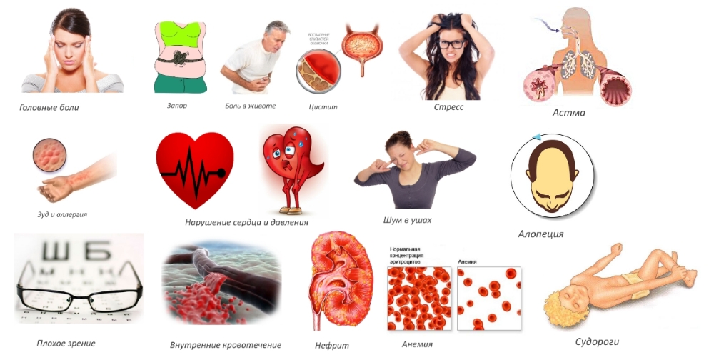 Побочные реакции от Ортофена Побочные реакции от Ортофена