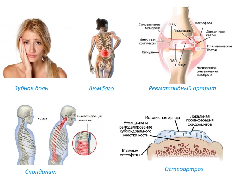 Показания к приему Аэртала Показания к приему Аэртала