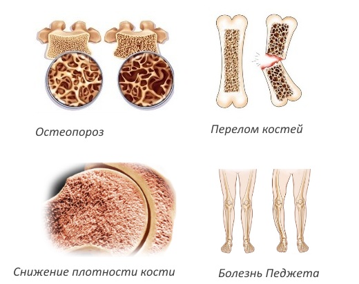 Показания для введения Акласты Показания для введения Акласты