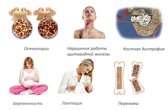 Показания для Альфадола Показания для Альфадола