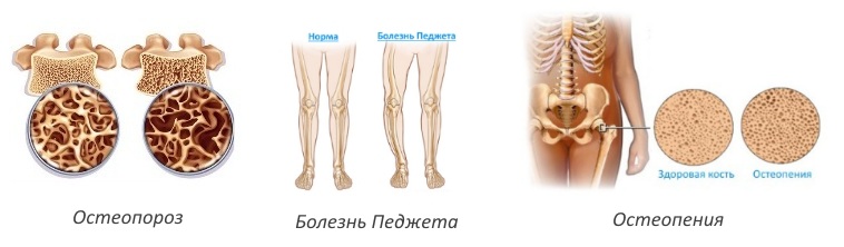 Показания для применения Алостина Показания для применения Алостина