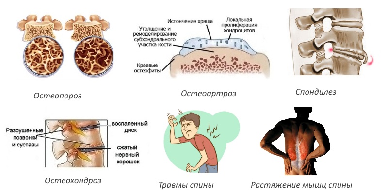 Показания для Артрина Показания для Артрина
