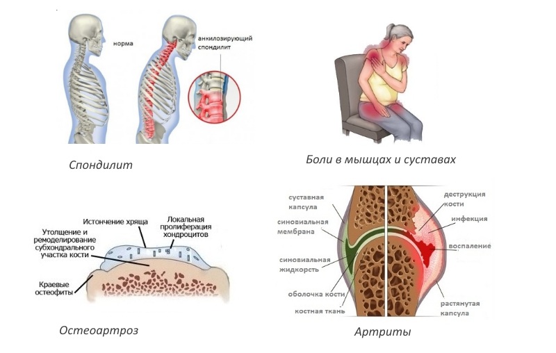 Показания для Артродока Показания для Артродока