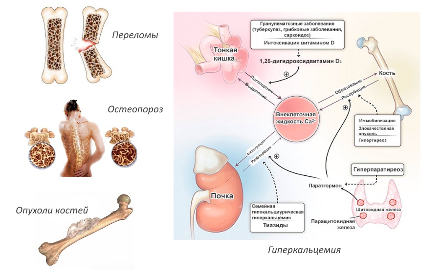 Показания для Бондроната Показания для Бондроната