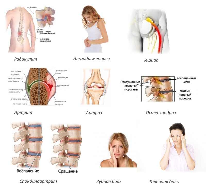 Показания для Дексалгина Показания для Дексалгина