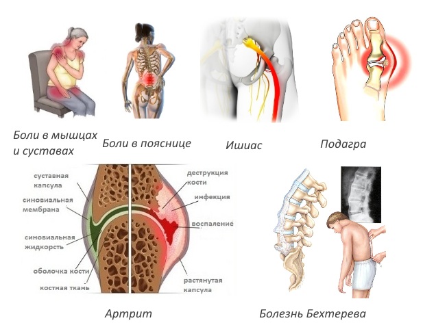 Показания для Дикловит геля Показания для Дикловит геля