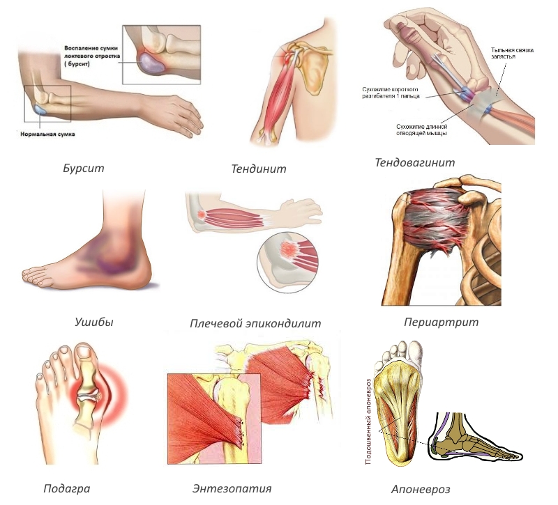 Показания для Долобене Показания для Долобене