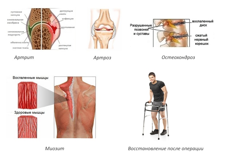 Показания для приема Джойнт Флекс Показания для приема Джойнт Флекс