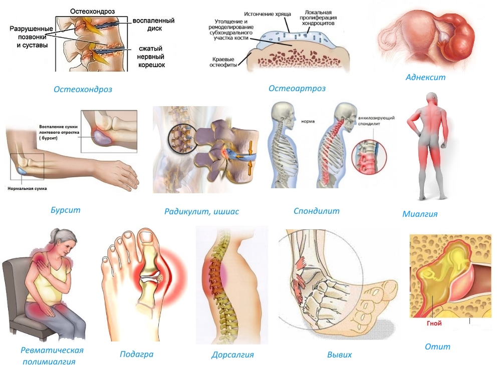 Показания для Флексена Показания для Флексена