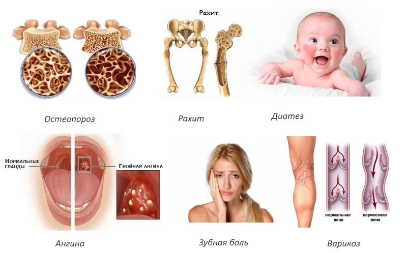 Показания для Калькохеля Показания для Калькохеля