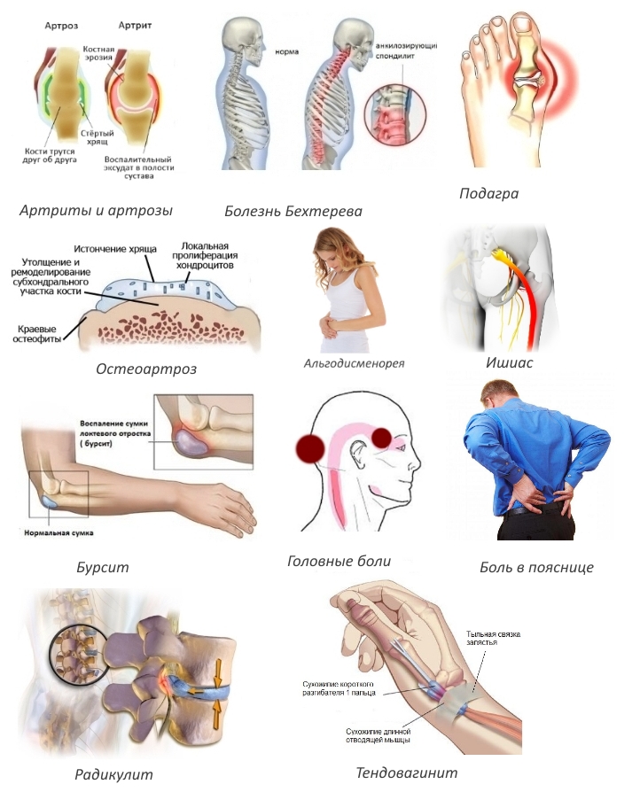 Показания для приема Ксефокама Показания для приема Ксефокама