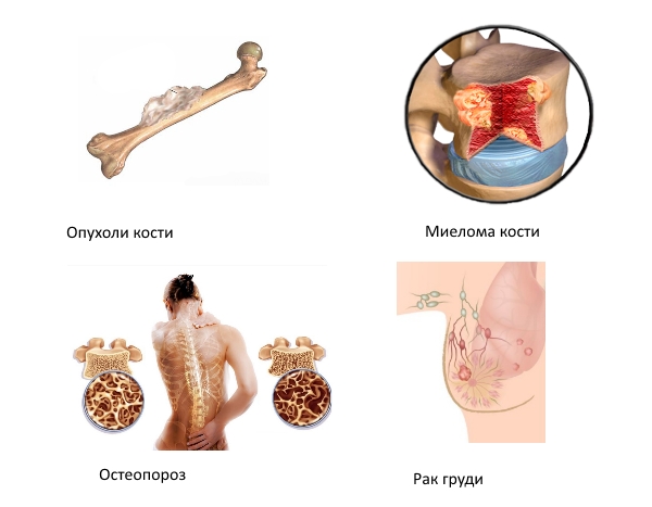 Показания для приема Резорбы Показания для приема Резорбы
