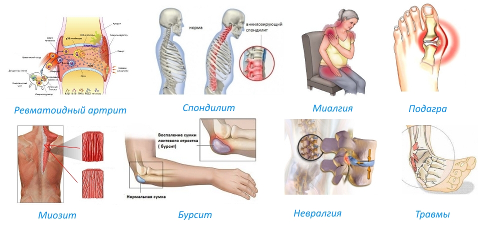 Показания для Тексамена Показания для Тексамена