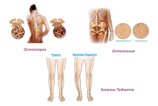 Показания для Вепрены Показания для Вепрены