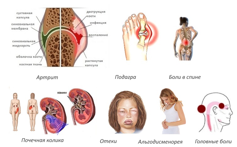 Показания для Вольтарена Показания для Вольтарена