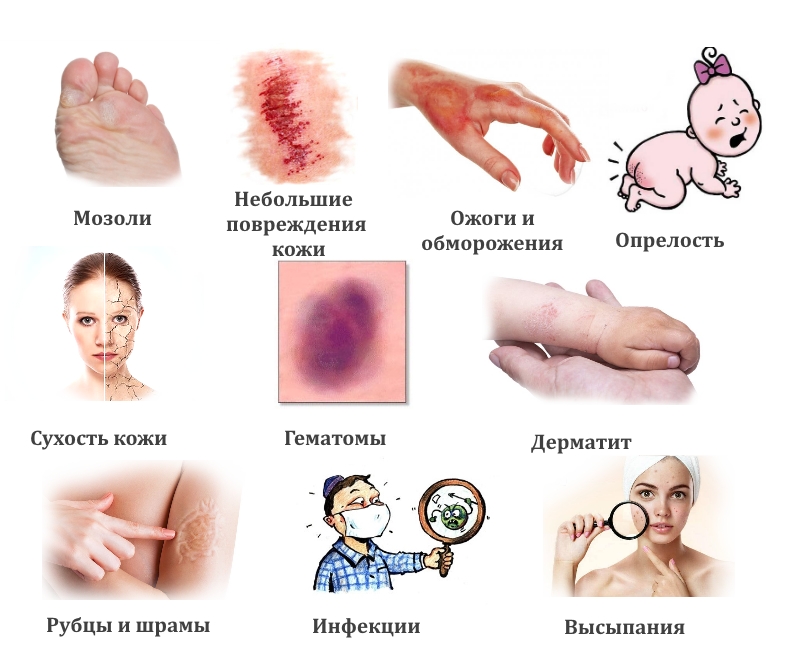 Показания для бальзама Спасатель Показания для бальзама Спасатель