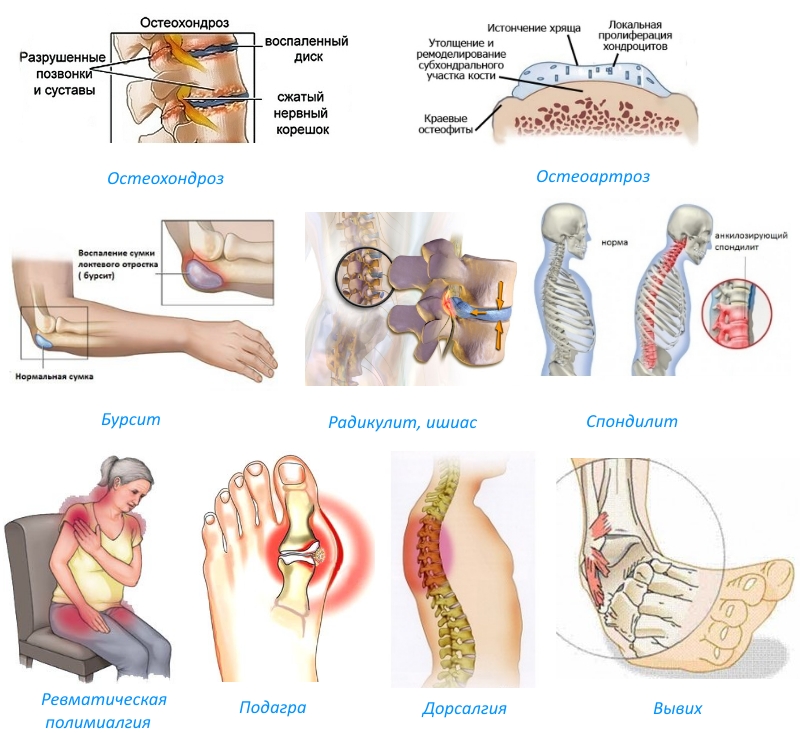 Показания для Флексена Показания для Флексена
