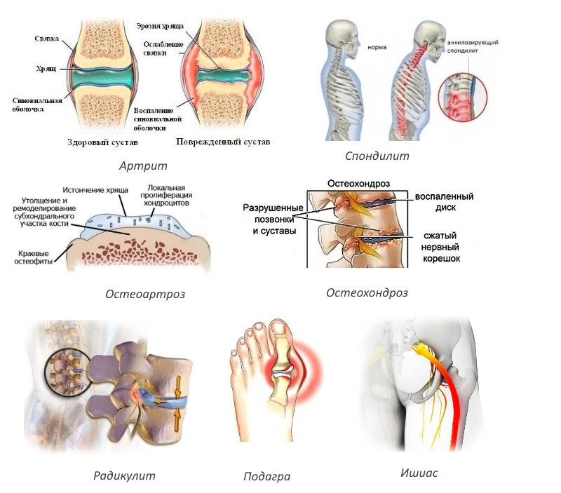 Показания для нанесения мази Найз Показания для нанесения мази Найз