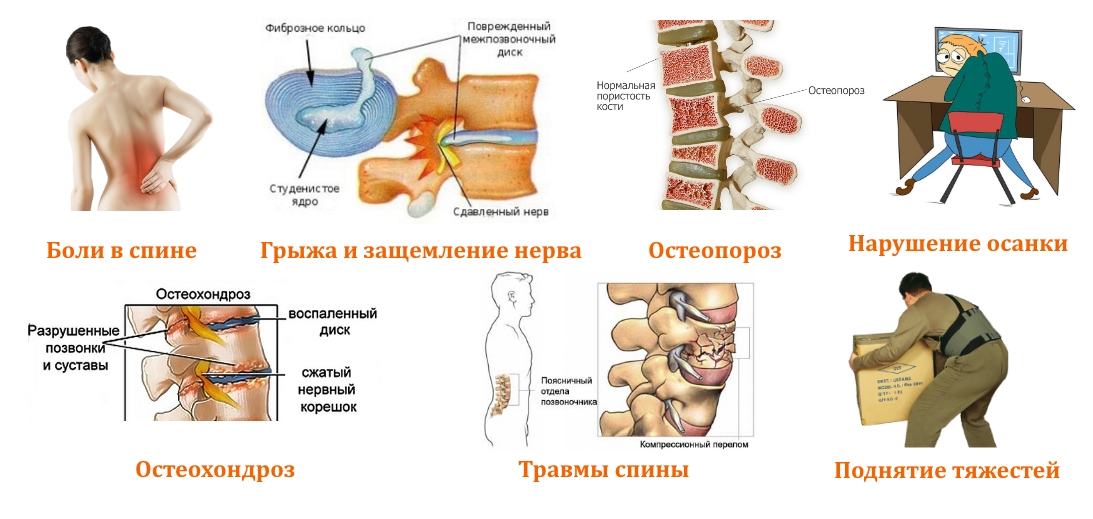 Показания для ношения бандажей Показания для ношения бандажей