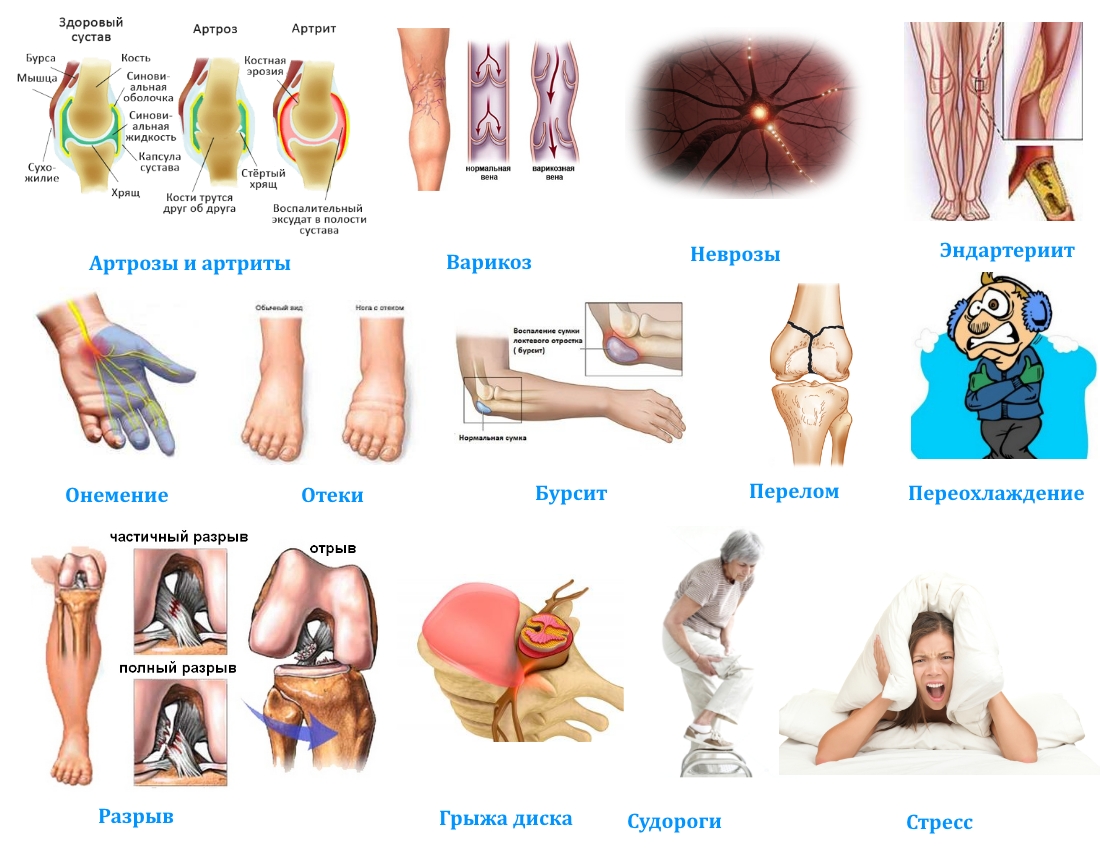 Показания для ношения турмалиновых наколенников Показания для ношения турмалиновых наколенников
