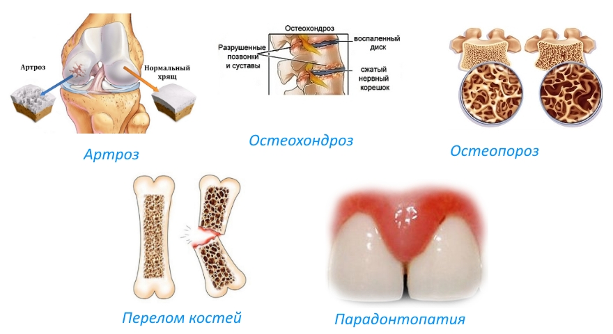 Мукосат Показания для приема Мукосата