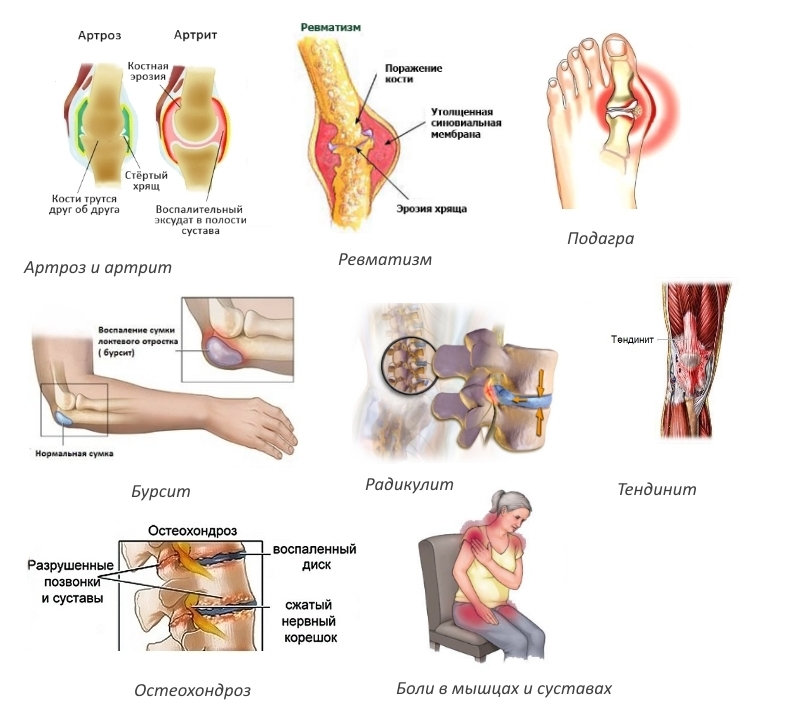 Показания для приема таблеток Найз Показания для приема таблеток Найз