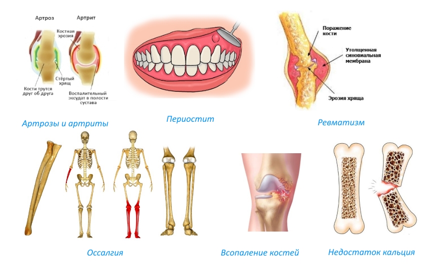 Показания для приема Остеохель С Показания для приема Остеохель С