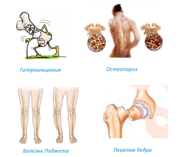 Показания для приема Резокластина Показания для приема Резокластина