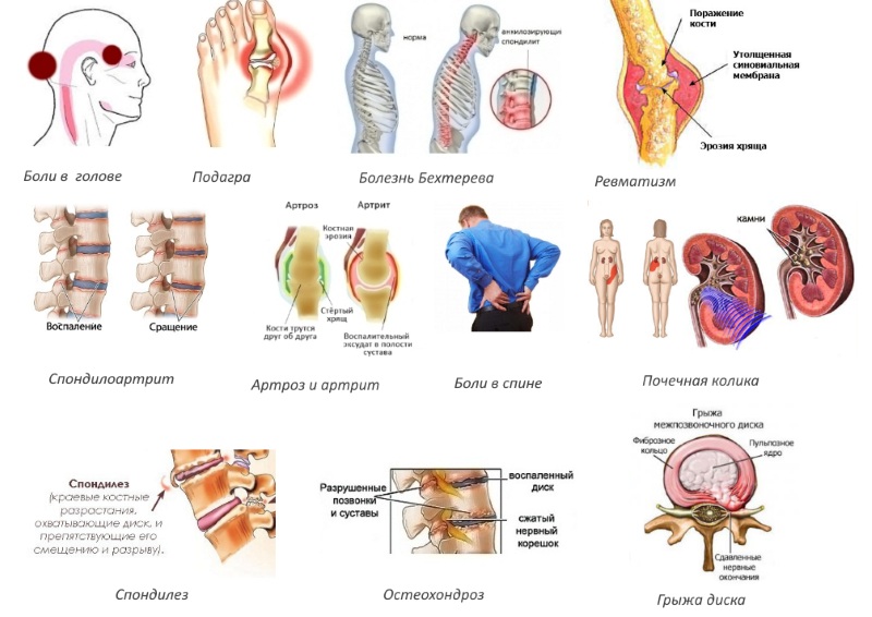 Показания для уколов Вольтарен Показания для уколов Вольтарен