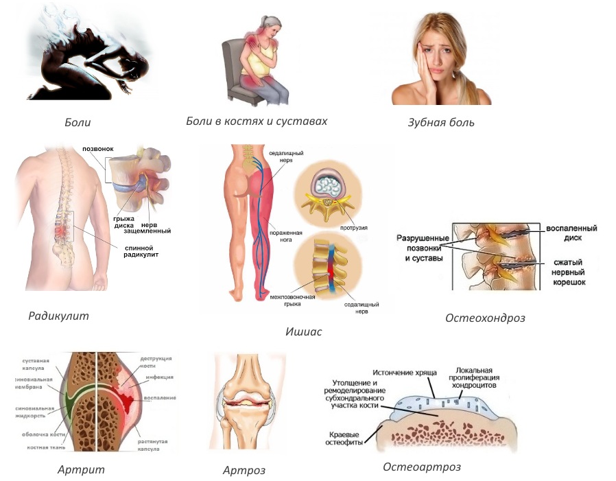 Показания к Декскетопрофену Показания к Декскетопрофену
