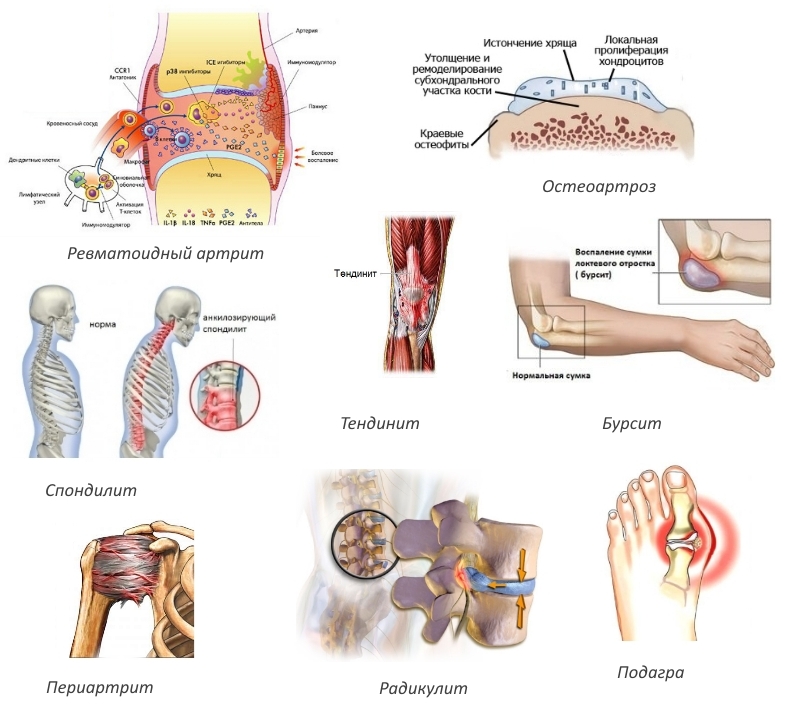 Показания к Окситену Показания к Окситену