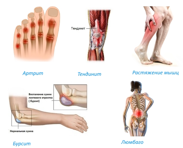 Показания к Сулайдин гелю Показания к Сулайдин гелю