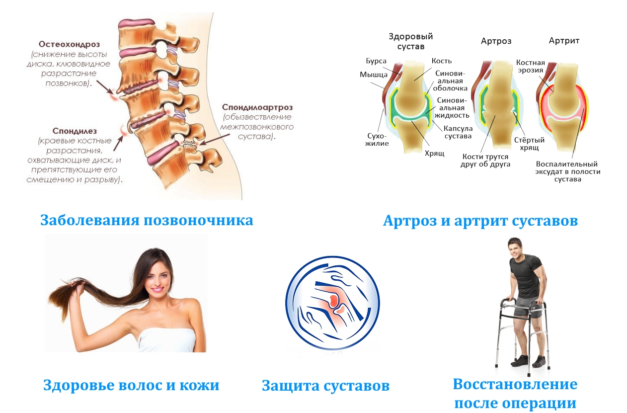 Показания к приему Эсобела Показания к приему Эсобела