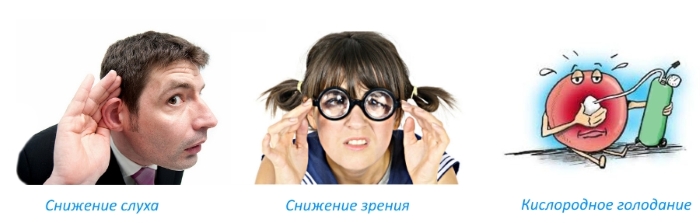 Последствия кифоза шеи Последствия кифоза шеи