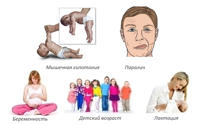 Противопоказания к Мускофлексу Противопоказания к Мускофлексу