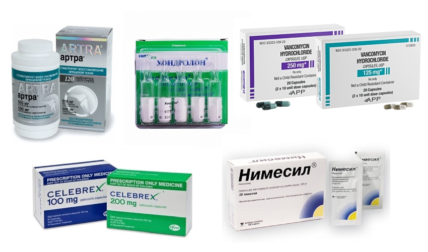 Препараты при боли в тазобедренном суставе Препараты при боли в тазобедренном суставе