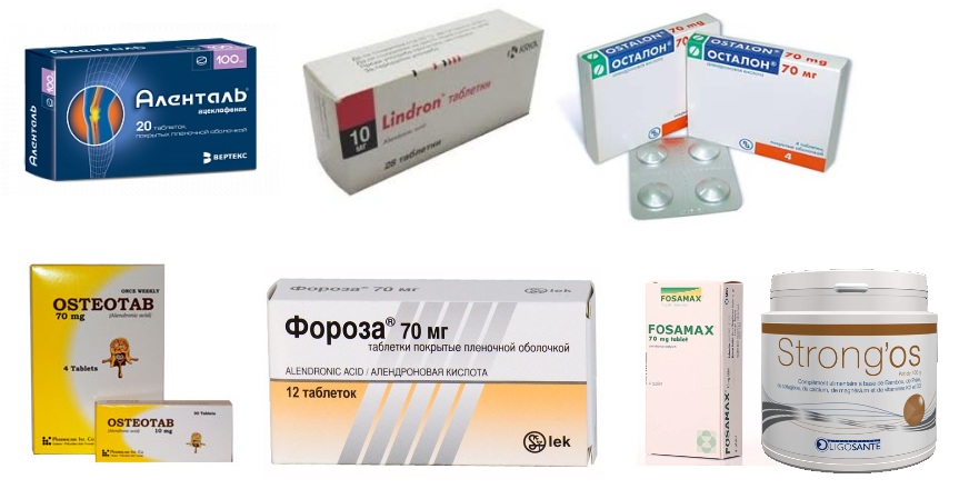 Препараты с алендроновой кислотой Препараты с алендроновой кислотой