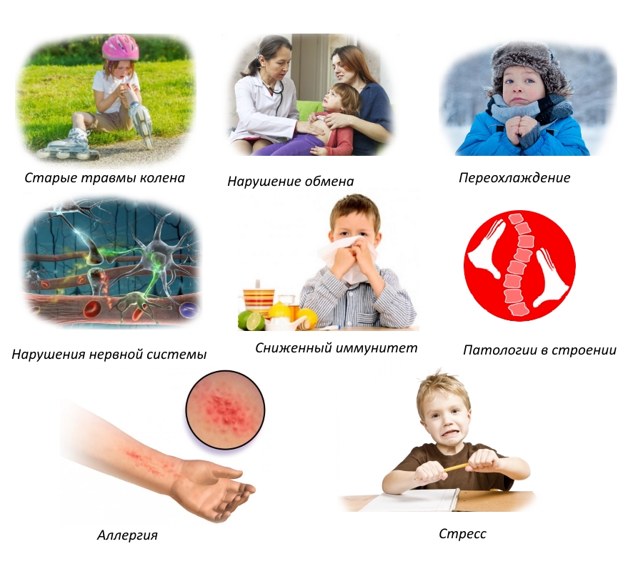 Причины артрита у детей Причины артрита у детей