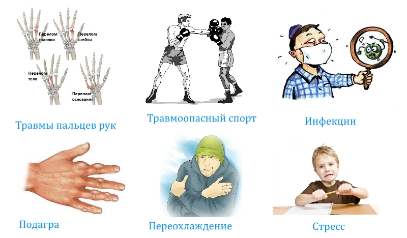 Причины артроза пальцев рук Причины артроза пальцев рук