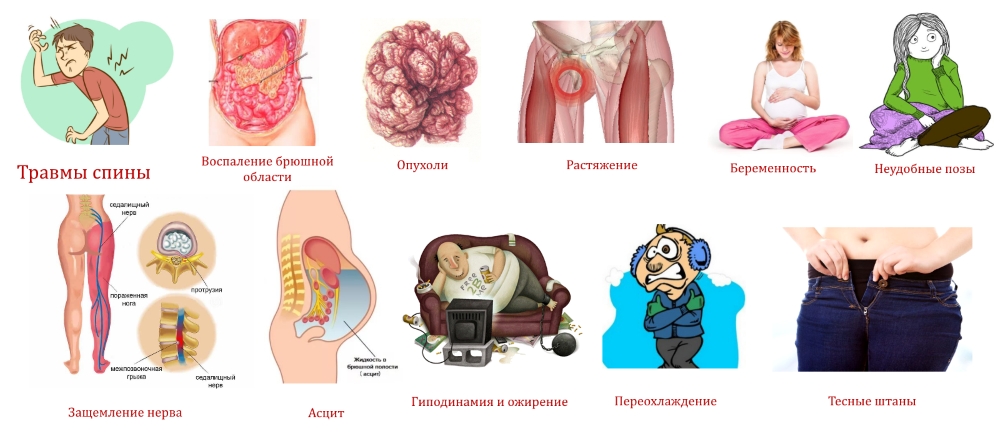 Причины болезни Рота Причины болезни Рота
