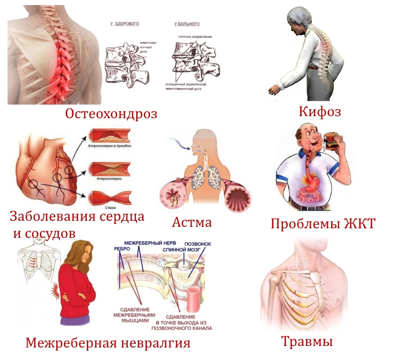 Причины боли в грудном отделе позвоночника Причины боли в грудном отделе позвоночника
