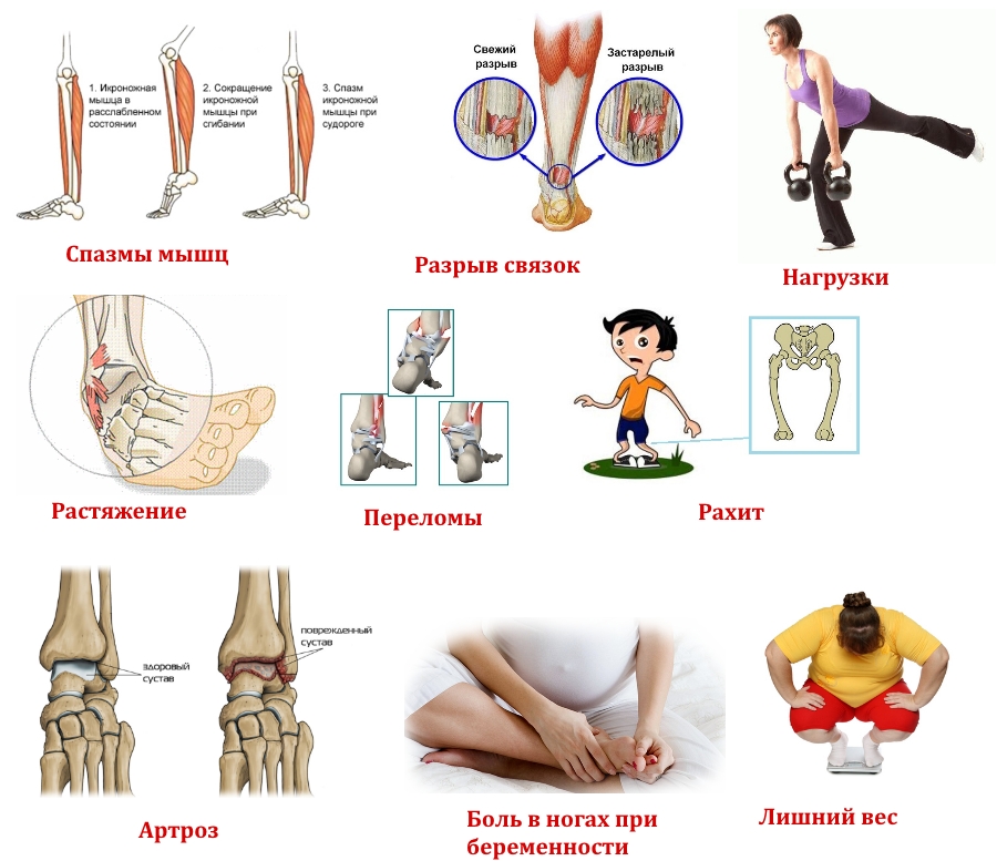 Частые причины боли в нижних конечностях Частые причины боли в нижних конечностях