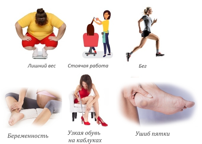 Частые причины боли в пятке Частые причины боли в пятке